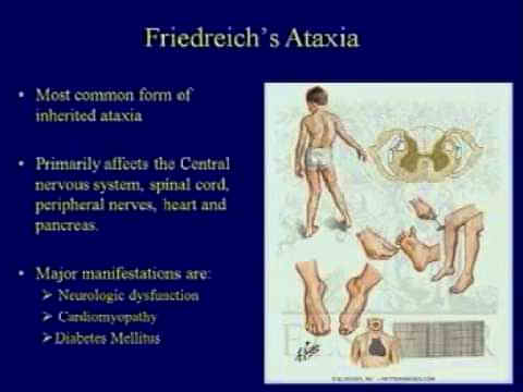 Friedreich’s ataxia